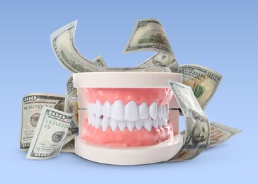 Image of Model of oral cavity with teeth and dollar banknotes on light blue background. Concept of expensive dental procedures
