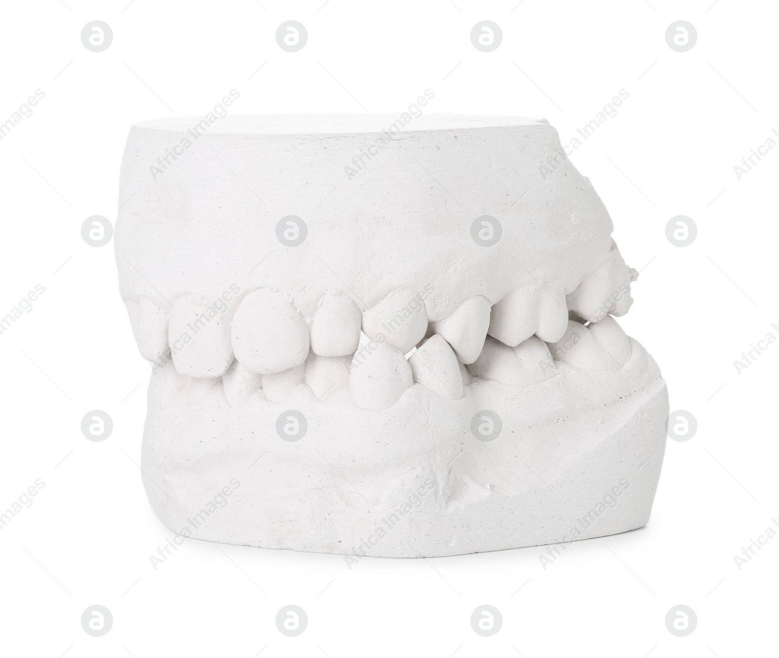 Photo of Dental model with gums isolated on white. Cast of teeth