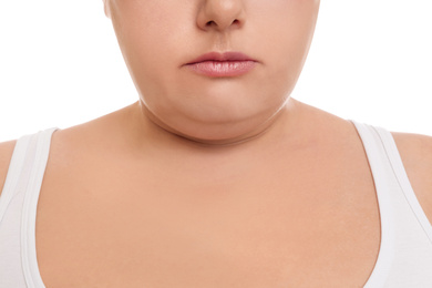 Photo of Woman with double chin on white background, closeup