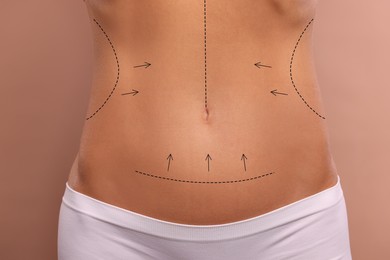 Image of Woman with markings for cosmetic surgery on her abdomen against light brown background, closeup