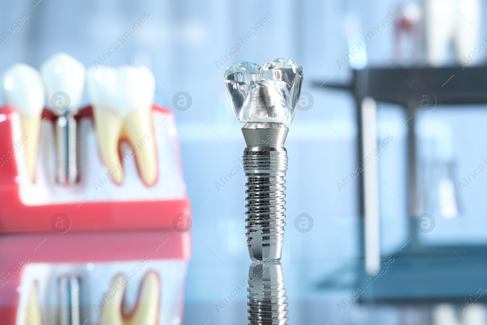 Photo of Educational model of dental implant on blurred background