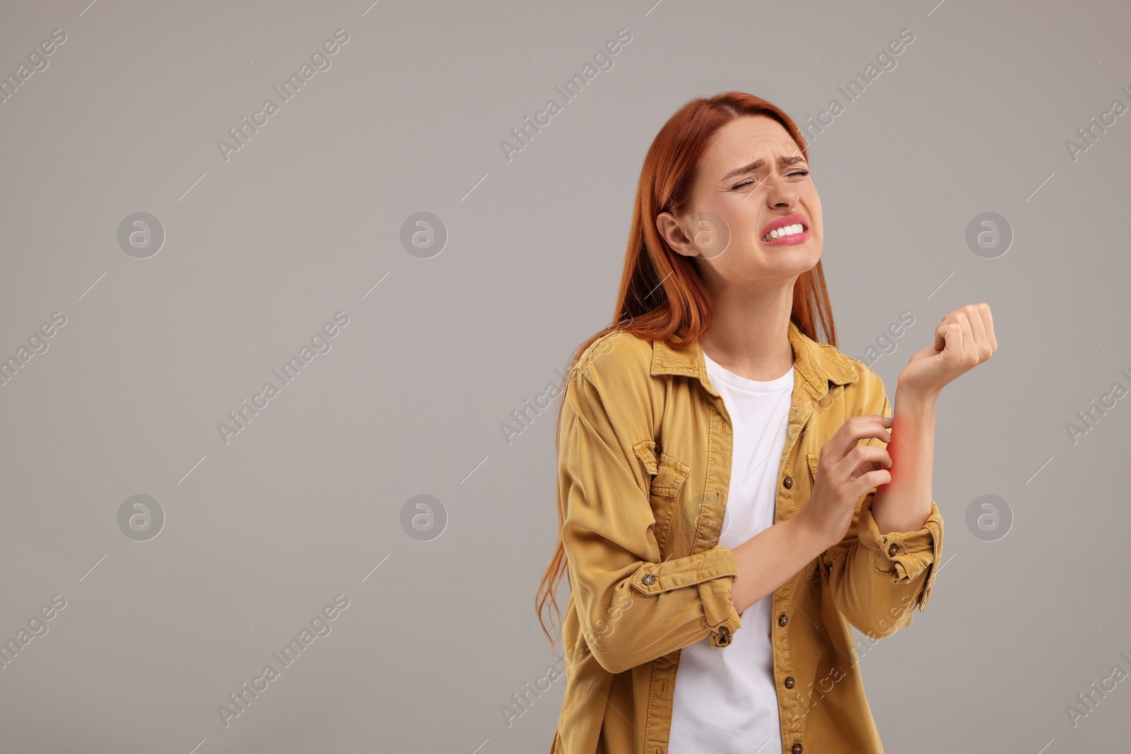 Photo of Suffering from allergy. Young woman scratching her arm on grey background, space for text