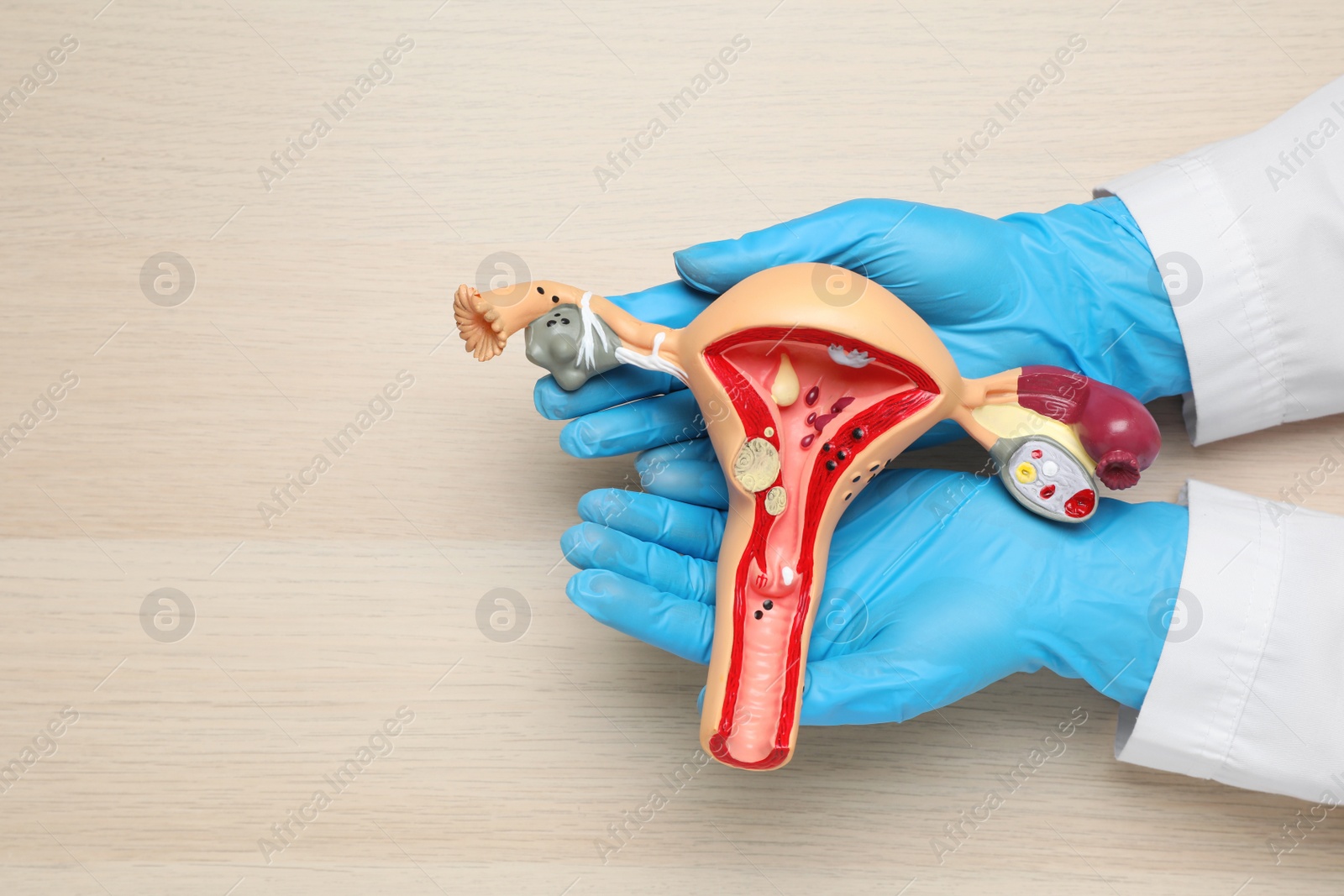 Photo of Gynecologist with anatomical model of uterus at wooden table, top view. Space for text