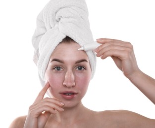 Young woman with acne problem applying cosmetic product onto her skin on white background