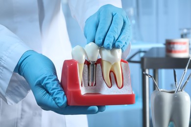 Photo of Dentist holding educational model of gum with dental implant between teeth indoors, closeup