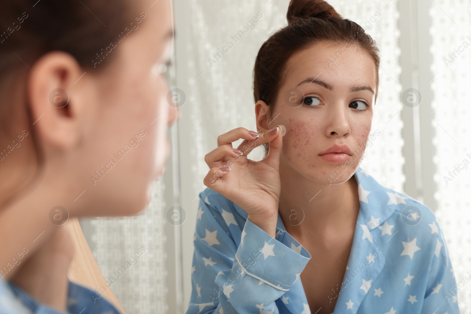 Photo of Teen girl applying acne healing patch near mirror in bathroom