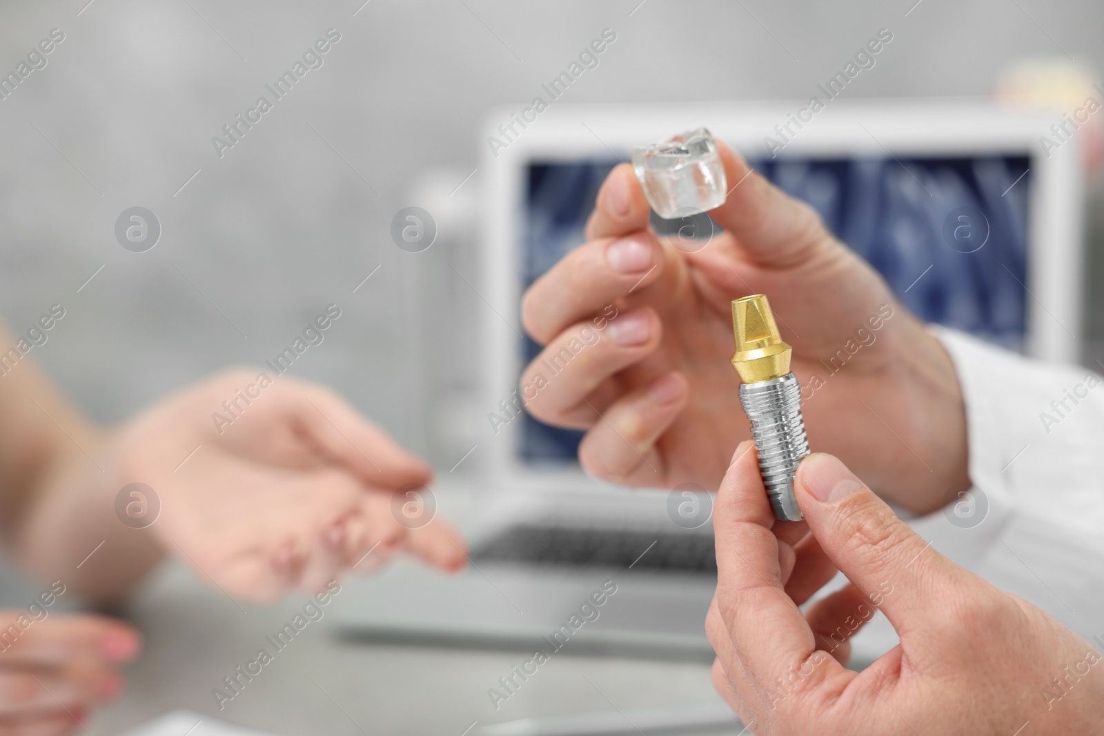 Photo of Doctor with educational model of dental implant consulting patient in clinic, closeup. Space for text