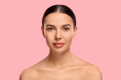Portrait of beautiful woman with markings before cosmetic surgery on pink background