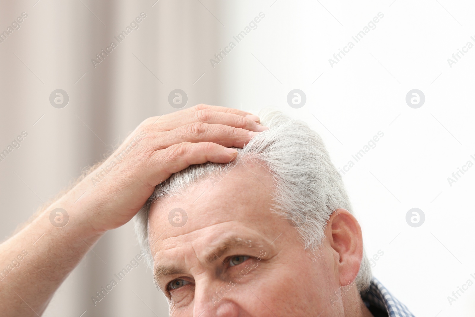 Photo of Senior man with hair loss problem indoors, closeup