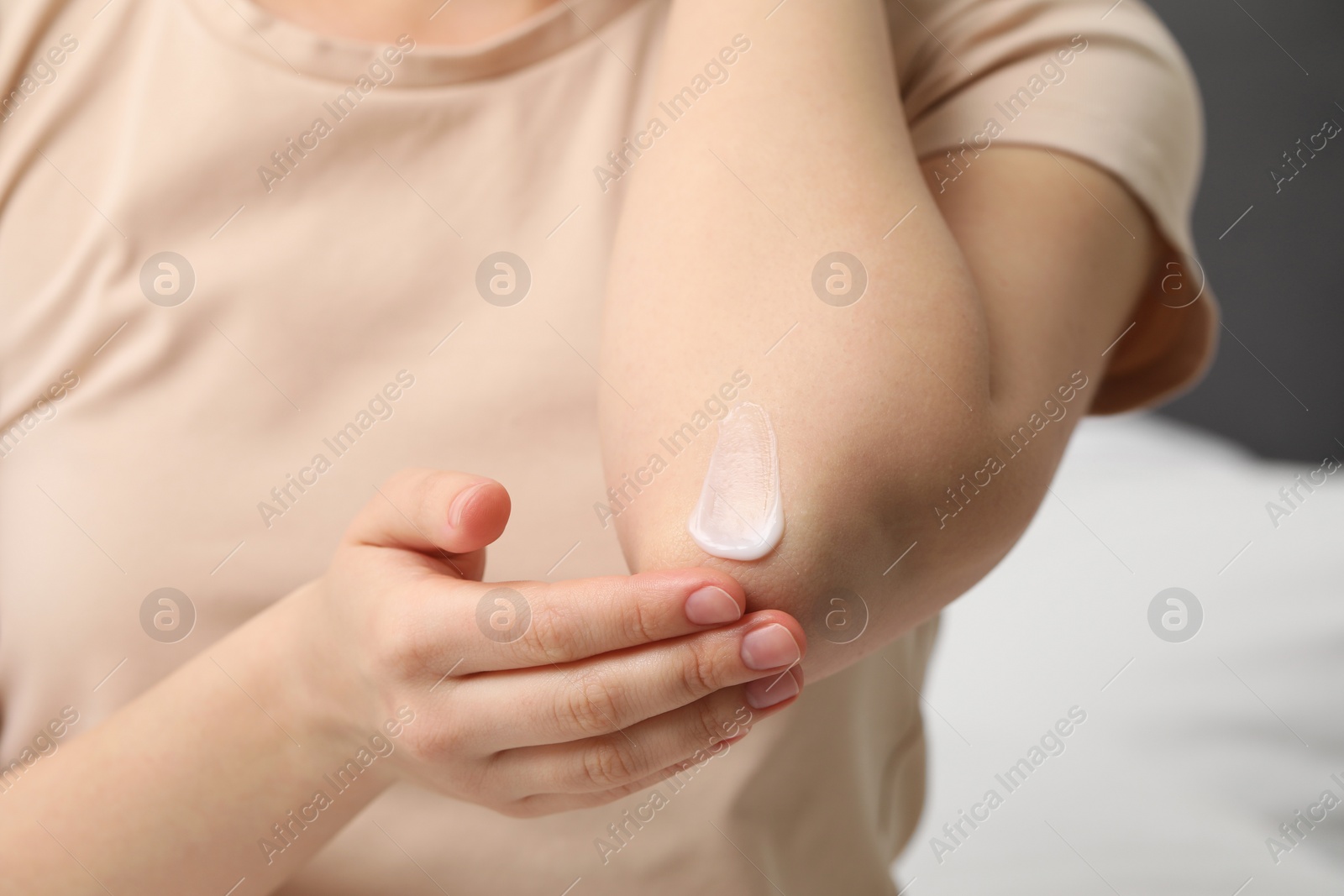 Photo of Young woman with dry skin applying cream onto her elbow indoors, closeup