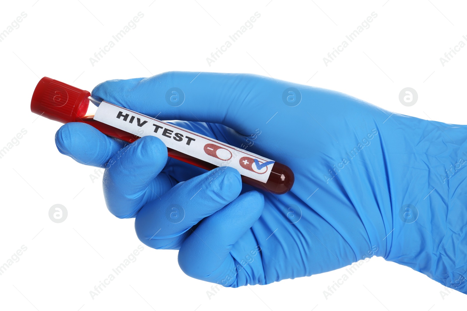 Photo of Scientist holding tube with blood sample and label HIV Test on white background, closeup