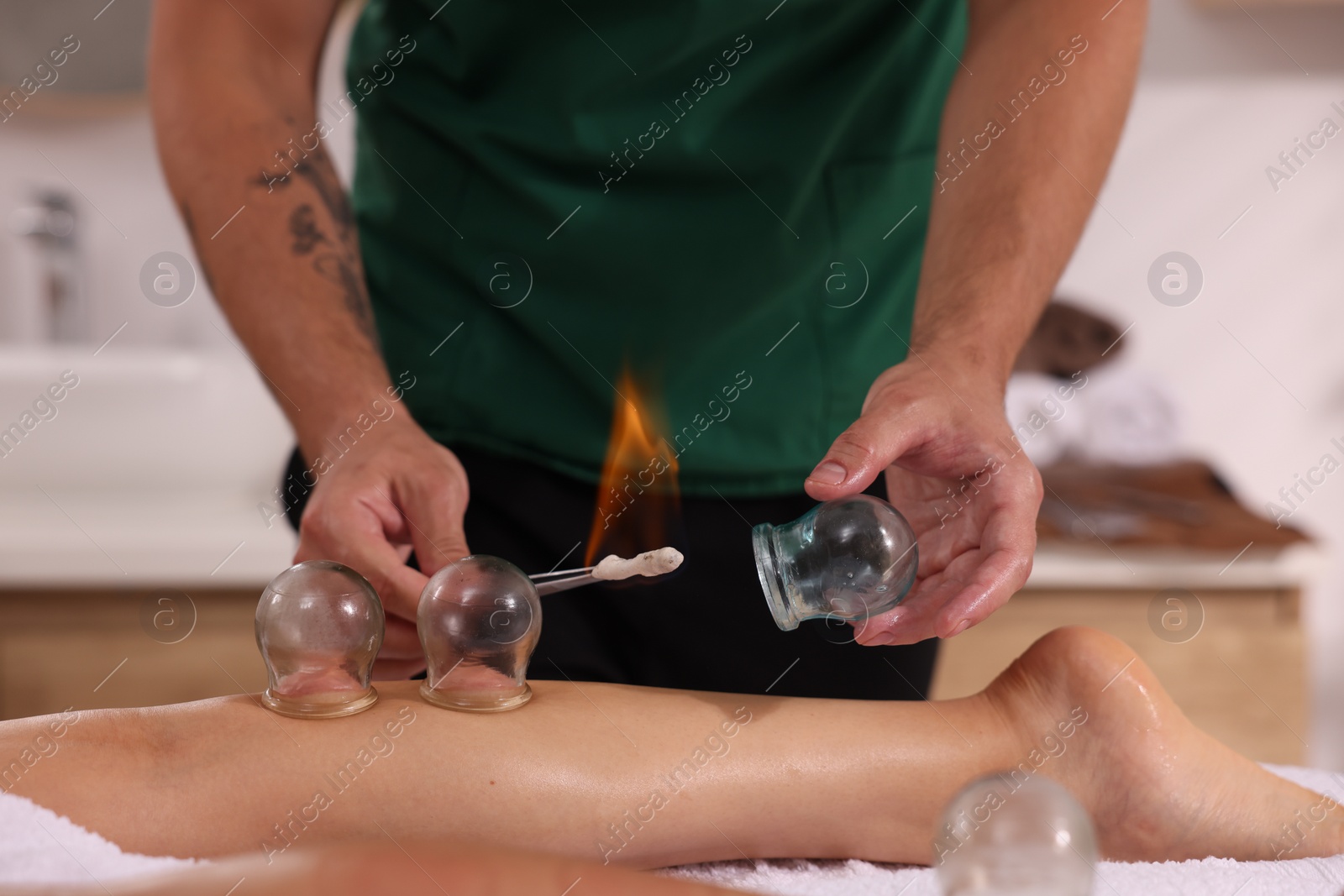 Photo of Therapist giving fire cupping treatment to patient in spa salon, closeup