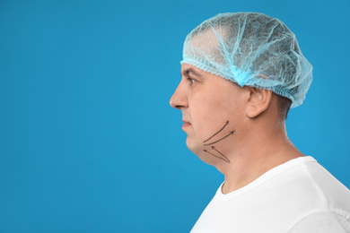 Mature man with marks on face against blue background, space for text. Double chin removal