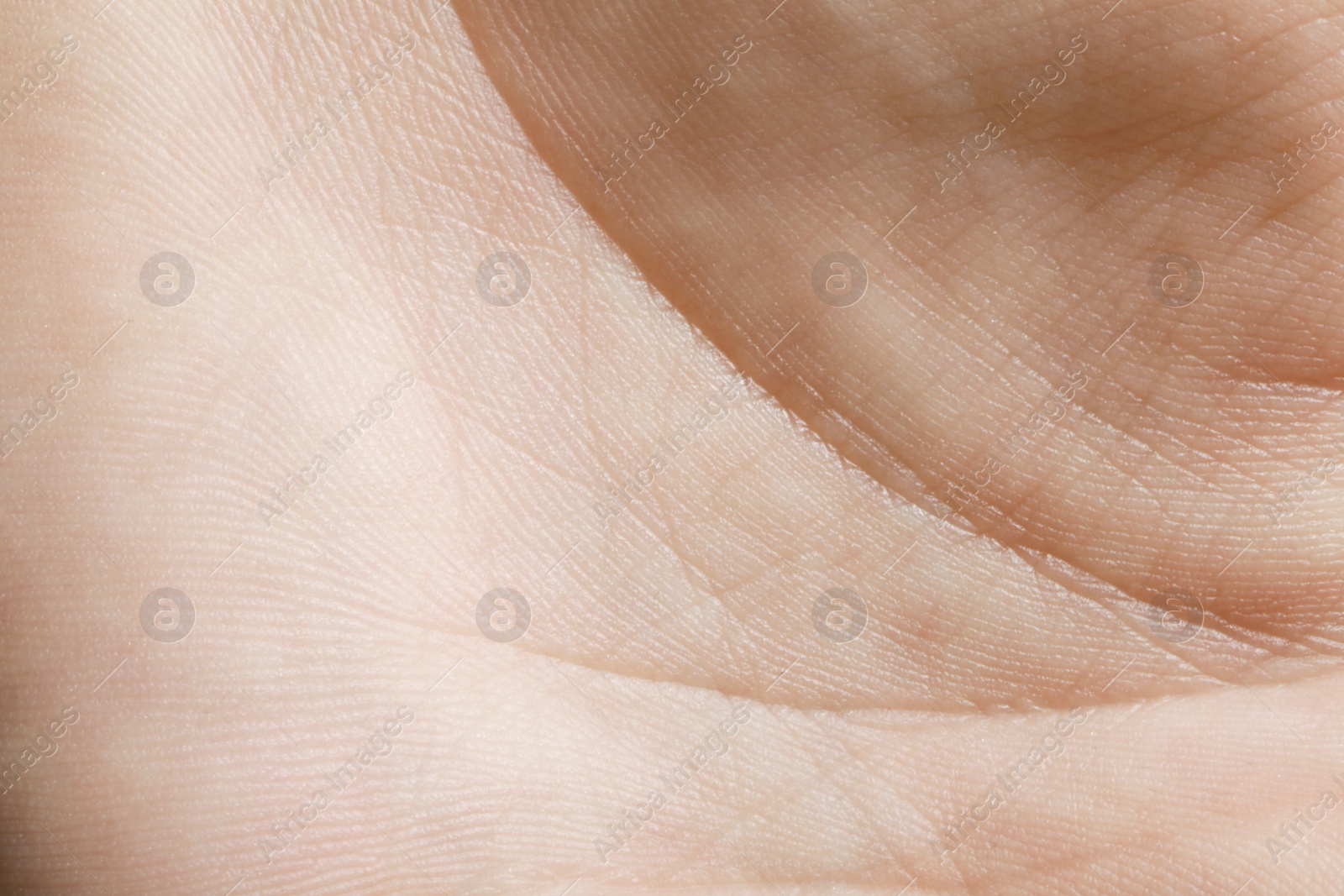 Photo of Closeup view of human hand with dry skin