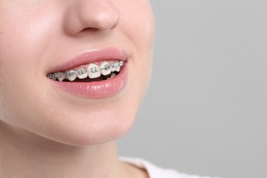 Smiling woman with dental braces on grey background, closeup. Space for text