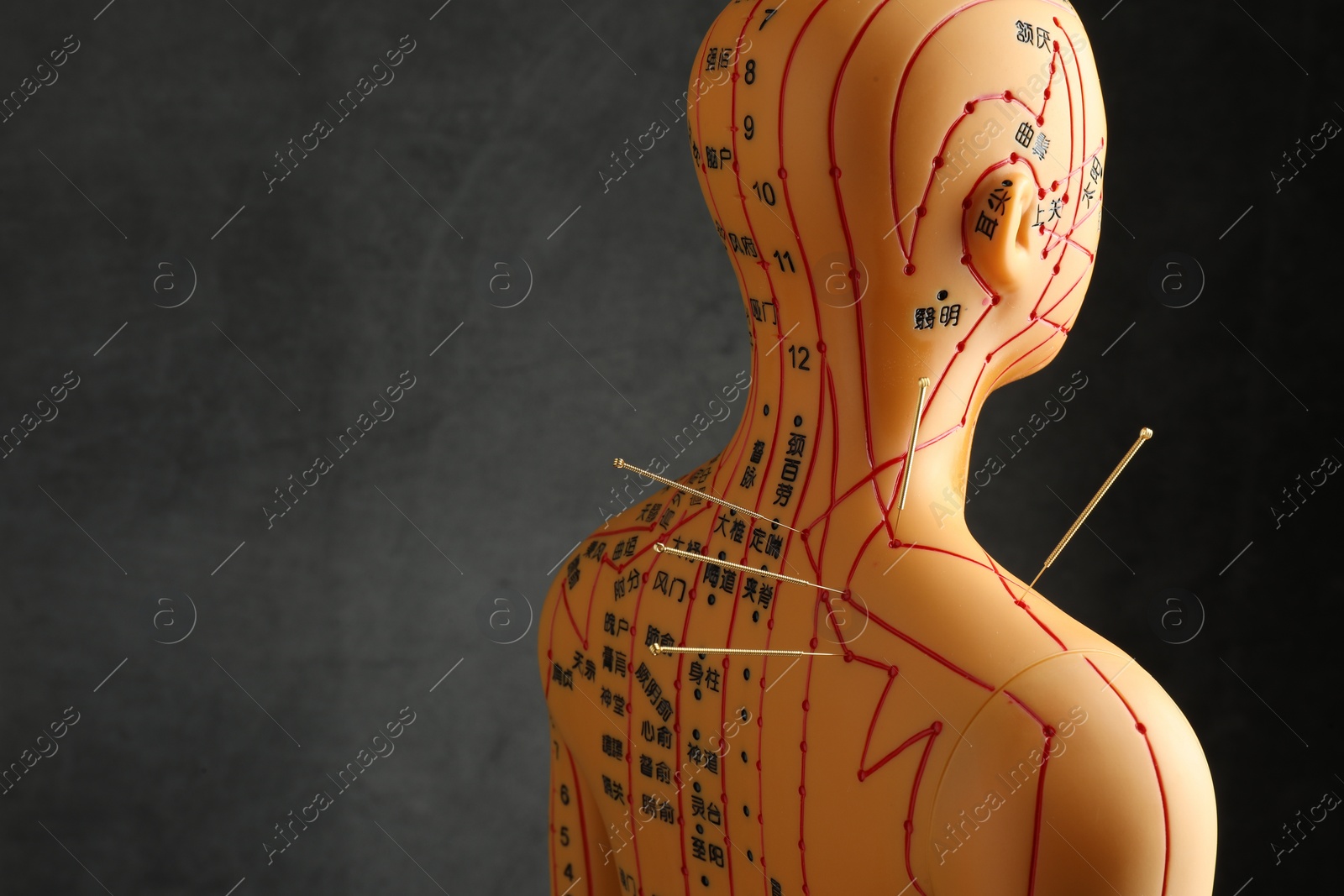Photo of Acupuncture - alternative medicine. Human model with needles in shoulder against dark grey background, space for text