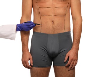 Man preparing for cosmetic surgery, white background. Doctor drawing markings on his abdomen, closeup