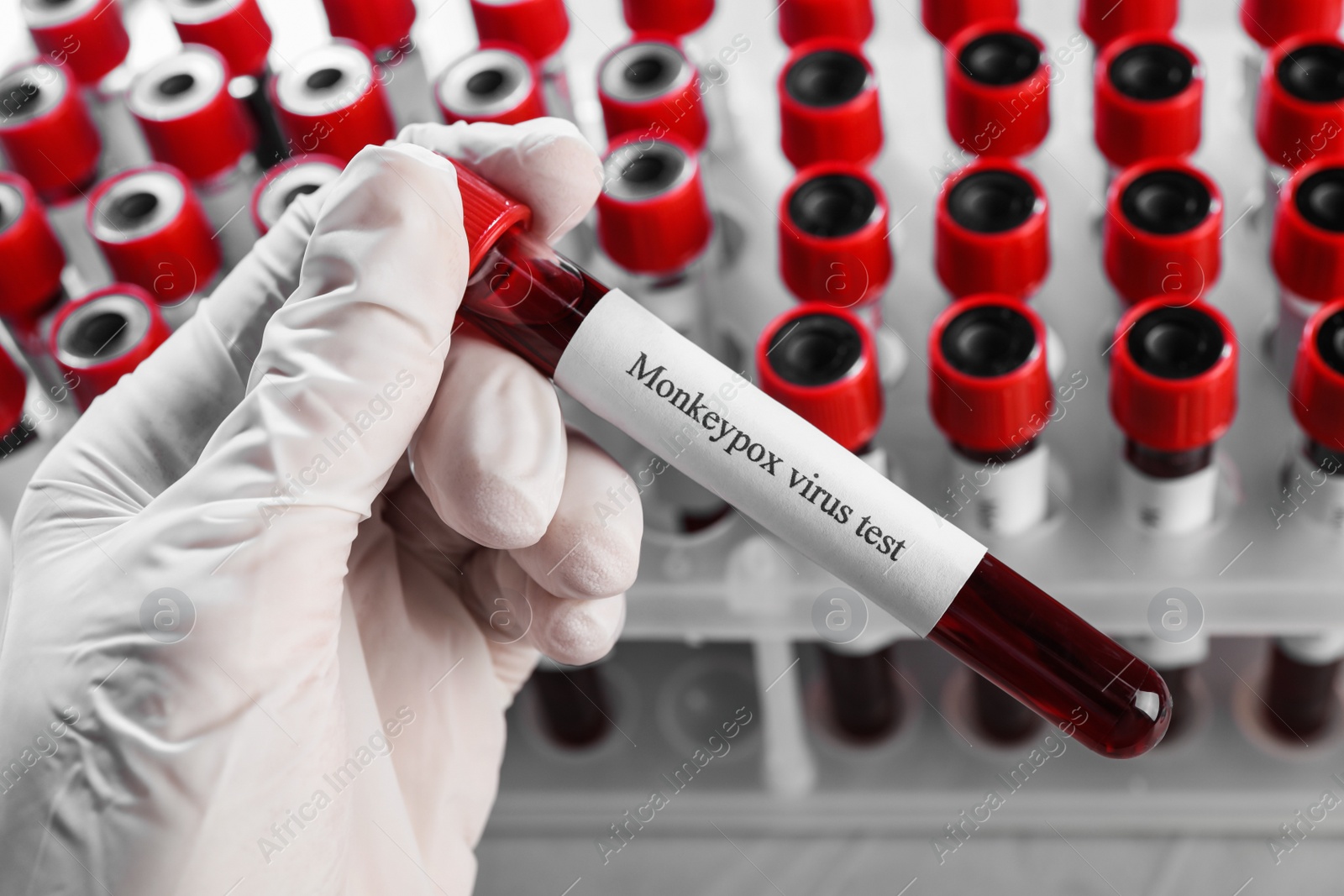 Photo of Monkeypox virus test. Laboratory worker holding sample tube with blood near rack, closeup