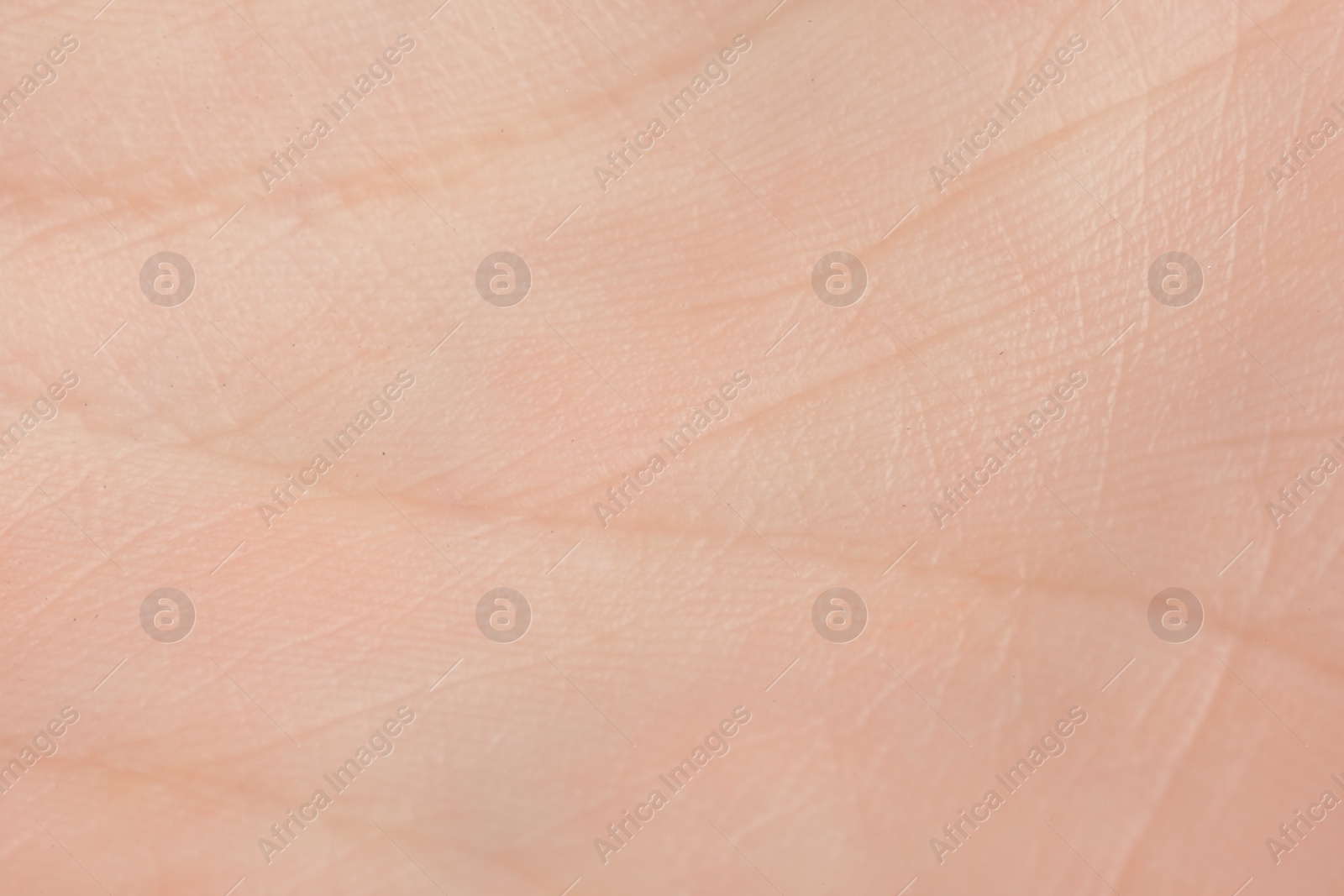 Photo of Texture of dry skin as background, macro view