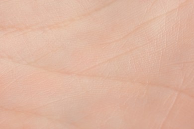 Photo of Texture of dry skin as background, macro view