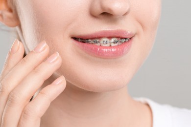 Photo of Smiling woman with dental braces on grey background, closeup