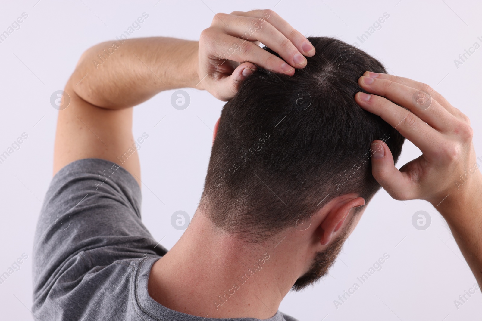 Photo of Man examining his hair and scalp on white background