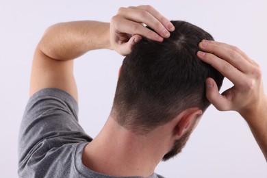 Man examining his hair and scalp on white background