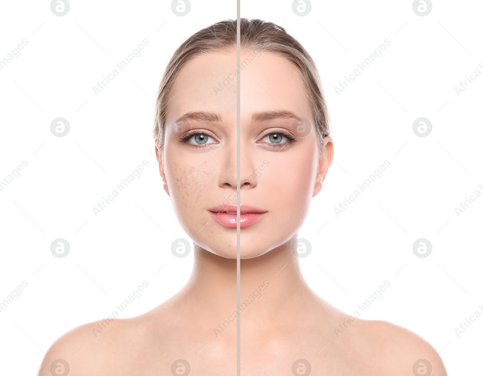 Image of Photo before and after retouch, collage. Portrait of beautiful young woman on white background 