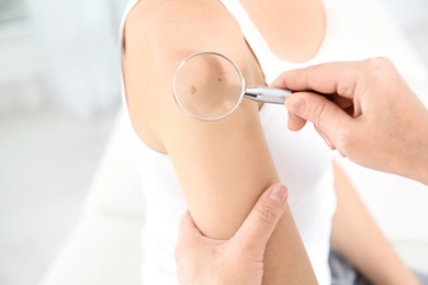 Dermatologist examining patient's birthmark with magnifying glass in clinic, closeup