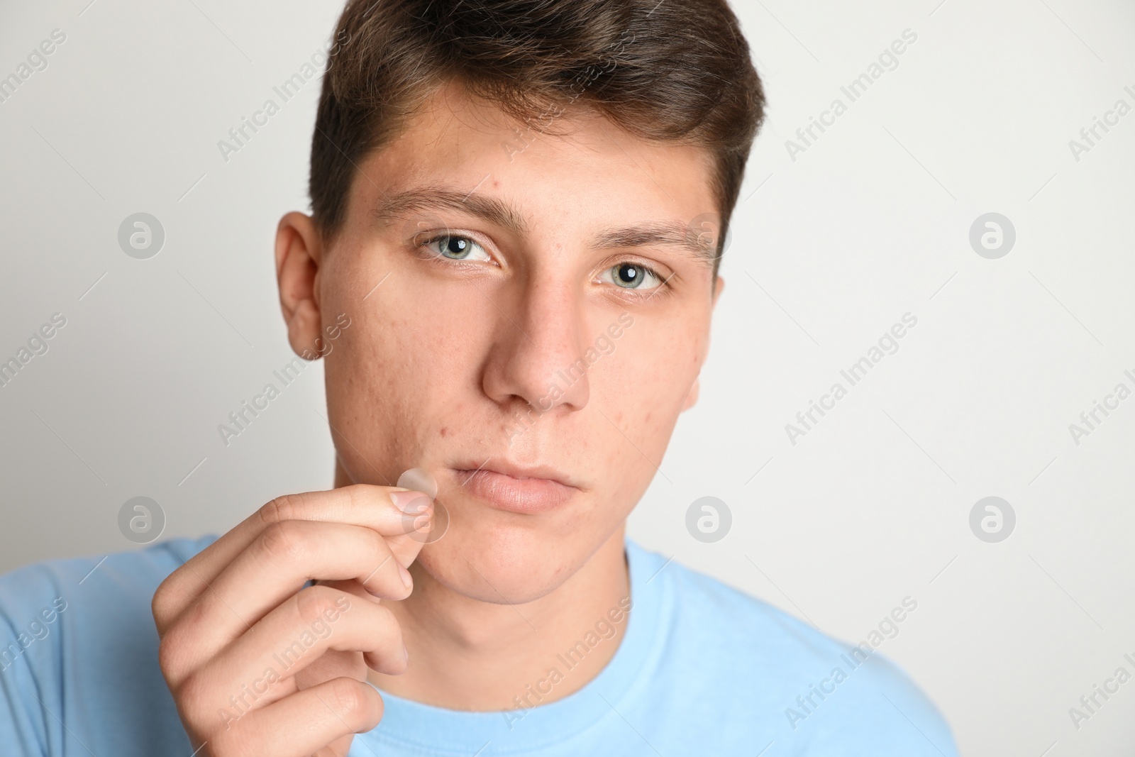 Photo of Teen guy applying acne healing patch on light background