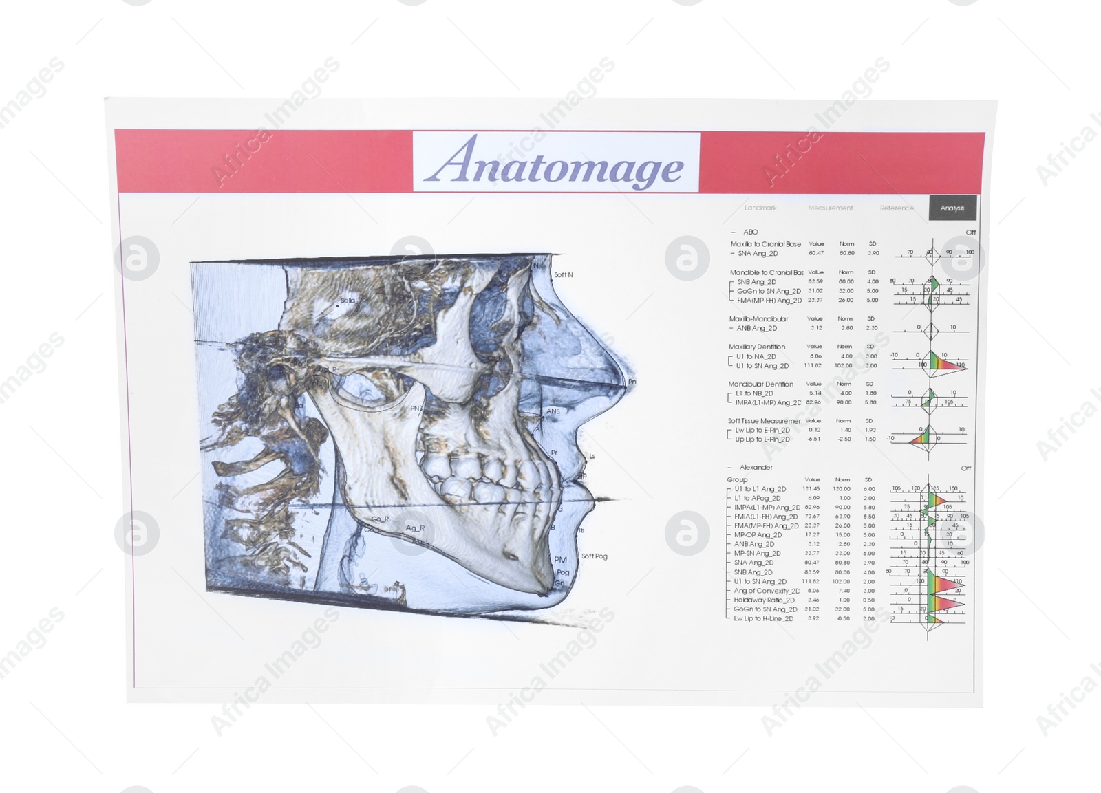 Photo of Visualization of human maxillofacial section for dental analysis printed on paper isolated on white