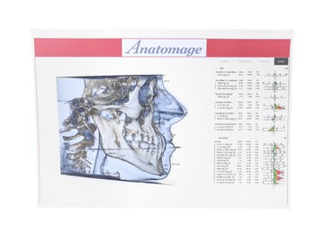 Visualization of human maxillofacial section for dental analysis printed on paper isolated on white