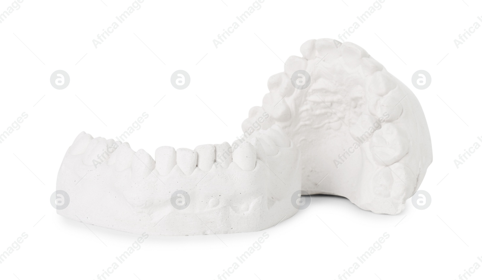 Photo of Dental model with gums isolated on white. Cast of teeth