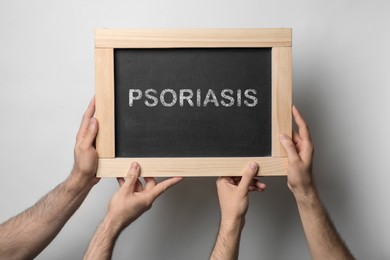Image of Men board with word PSORIASIS on light background, closeup 