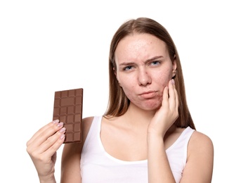 Photo of Young woman with acne problem holding chocolate bar on white background. Skin allergy