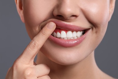 Photo of Young woman showing inflamed gums on grey background, closeup