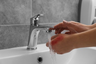 Woman holding burned hand under cold water indoors, closeup. Space for text