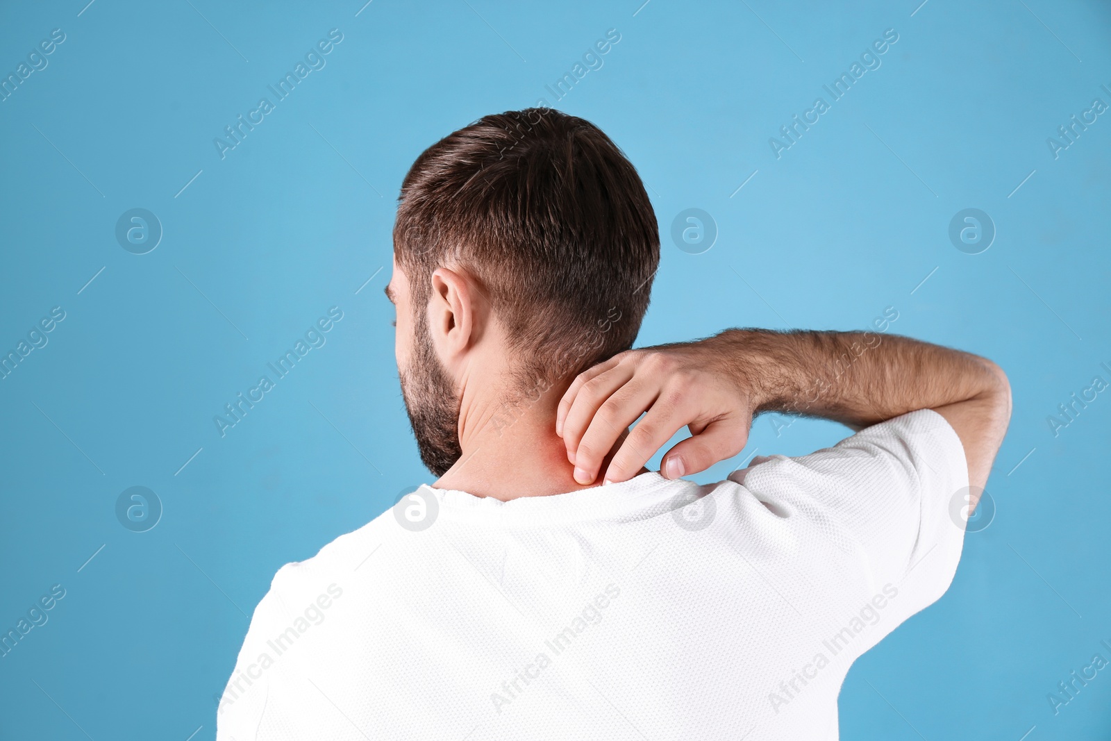 Photo of Young man scratching neck on color background. Allergies symptoms