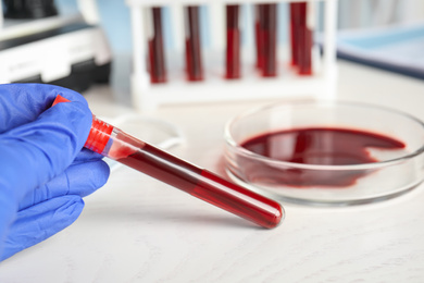 Photo of Scientist holding test tube with blood sample at table, closeup. Virus research