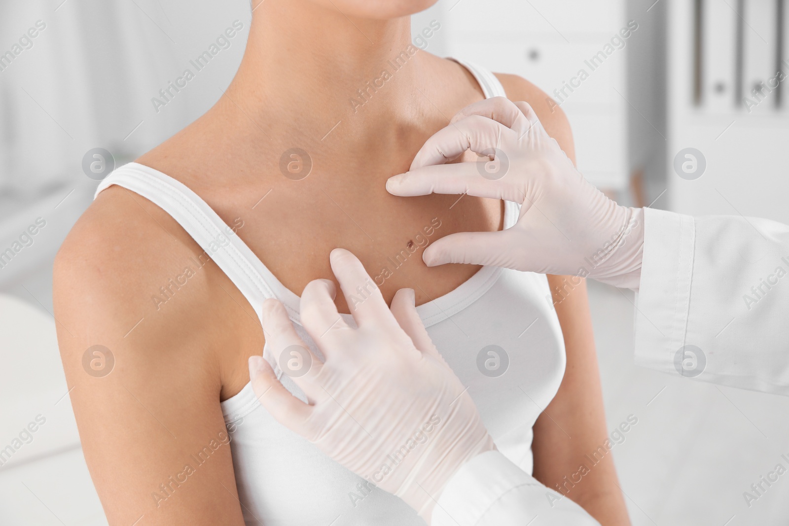 Photo of Dermatologist examining patient's birthmark in clinic, closeup