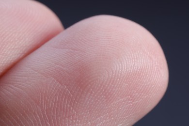 Photo of Finger with friction ridges on dark background, macro view