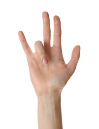 Woman with trigger finger condition on white background, closeup