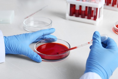 Laboratory worker pipetting blood sample into Petri dish for analysis on table, closeup