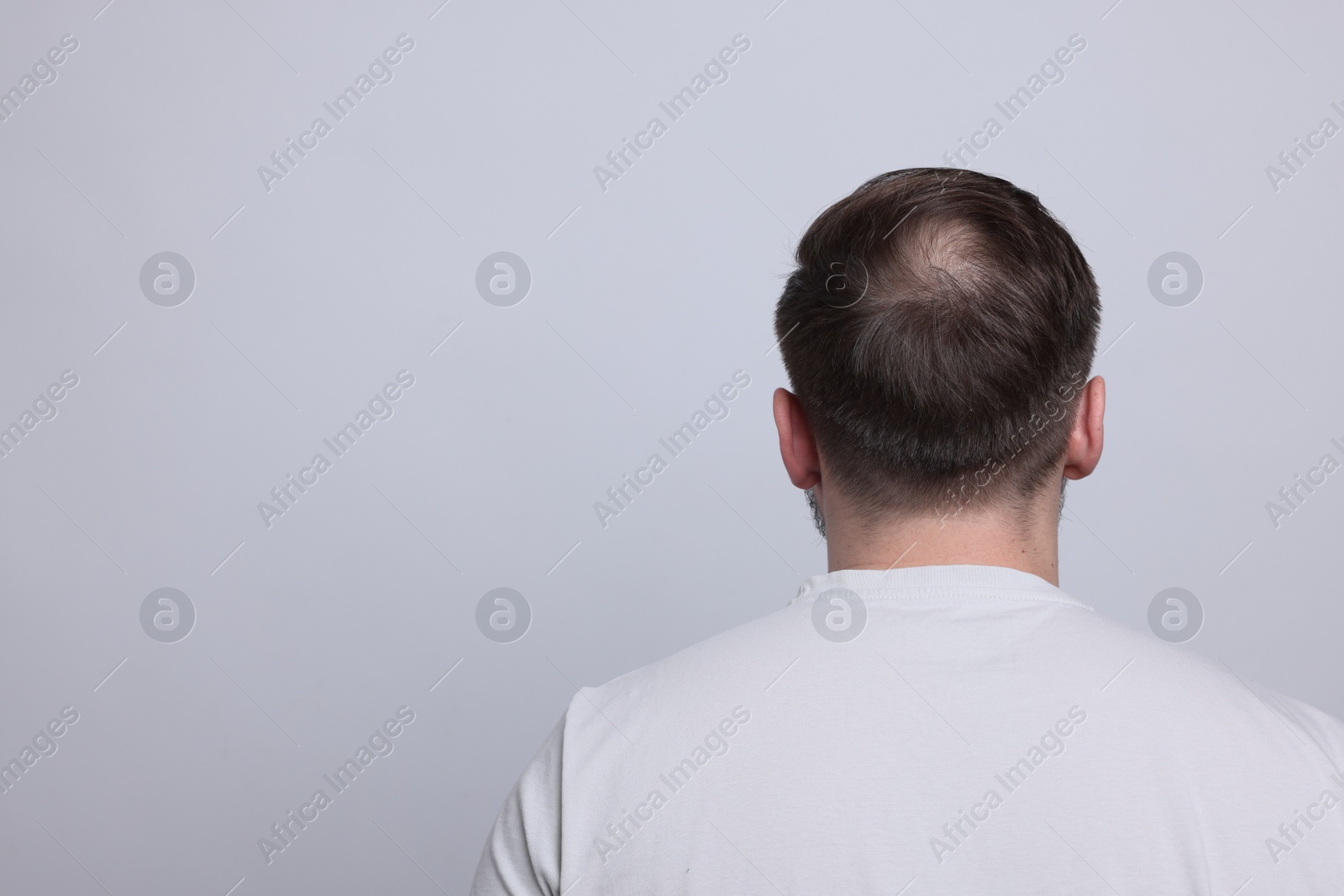 Photo of Baldness concept. Man with bald spot on light grey background, back view. Space for text