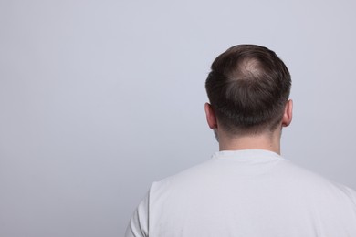 Baldness concept. Man with bald spot on light grey background, back view. Space for text