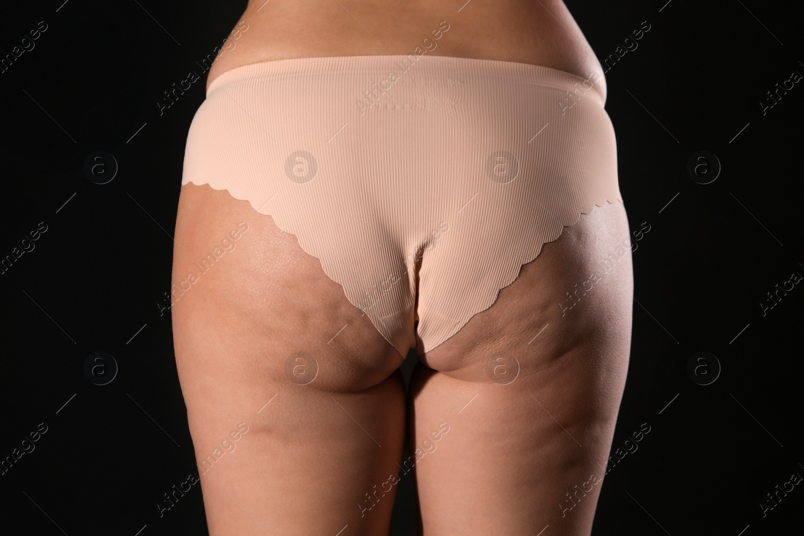 Photo of Woman with cellulite on black background, closeup