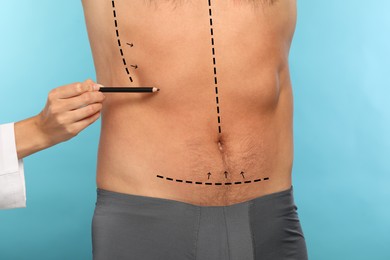 Image of Man preparing for cosmetic surgery, light blue background. Doctor drawing markings on his abdomen, closeup