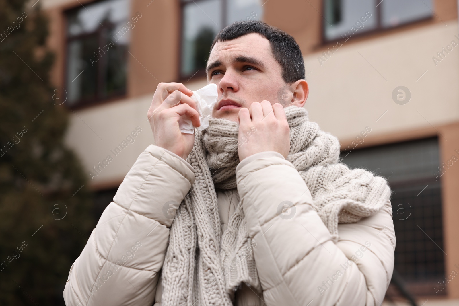 Photo of Sick young man with tissue on city street. Cold symptoms