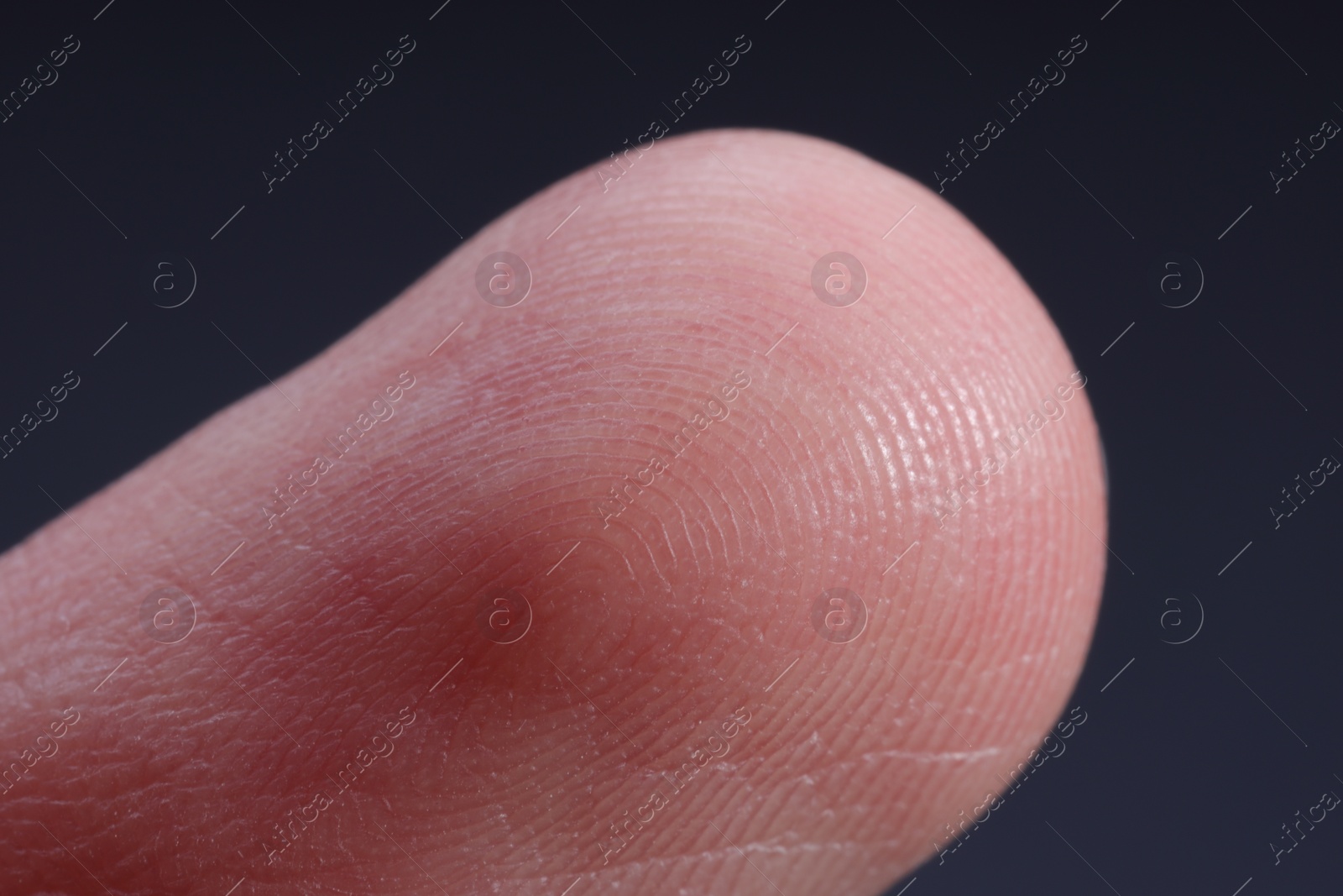 Photo of Finger with friction ridges on dark background, macro view