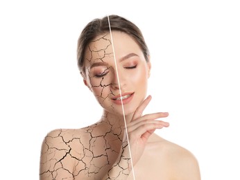 Image of Collage with photos of woman having dry skin problem before and after dry skin problem on white background